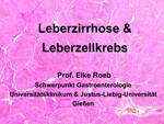 Leberzirrhose & Leberzellkrebs