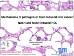 Mechanisms of pathogen or toxin induced liver cancer: NASH and NASH induced HCC